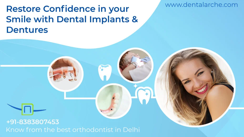 Dentures Vs Dental Implants: Pros and Cons. Which one is right for you?