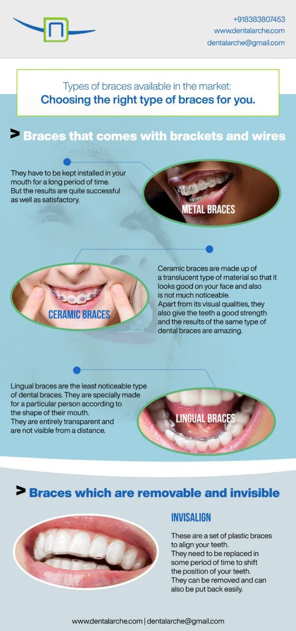 dental-arche-dental-braces-infographics